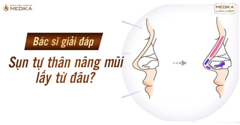 Bác sĩ giải đáp: sụn tự thân nâng mũi lấy từ đâu? - Bệnh viện thẩm mỹ MEDIKA