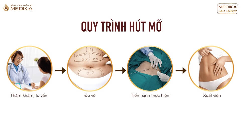 quy-trinh-hut-mo-tai-benh-vien-tham-my-medika