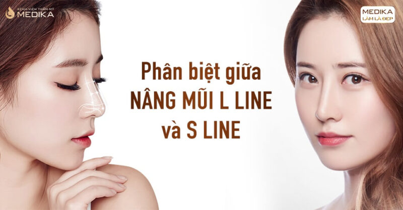 Phân biệt giữa nâng mũi L line và S line - Bệnh viện thẩm mỹ MEDIKA