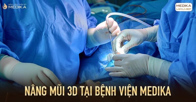 Nâng mũi 3D tại Bệnh viện thẩm mỹ MEDIKA