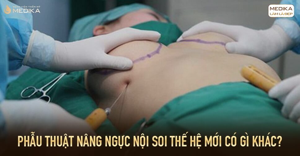 Phẫu thuật nâng ngực thế hệ mới có gì khác ở Bệnh viện thẩm mỹ MEDIKA?