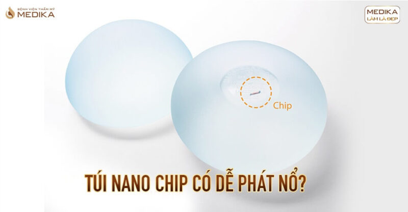 Túi Nano Chip có dễ phát nổ tại Bệnh viện thẩm mỹ MEDIKA?