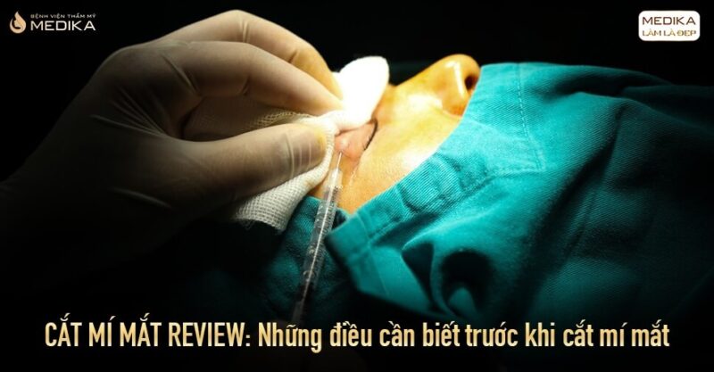 Cắt mí mắt review: Những điều cần biết trước khi cắt mí mắt