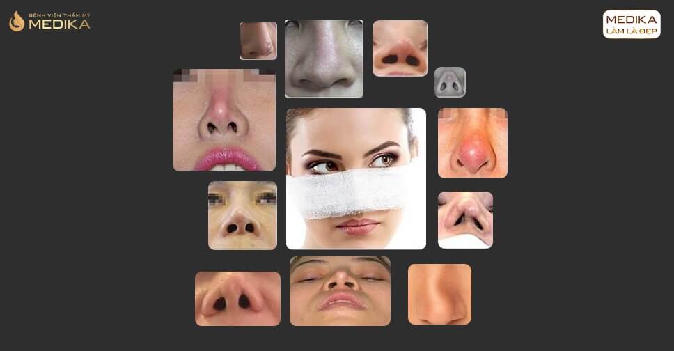 Hệ lụy từ quảng cáo phẫu thuật nâng mũi đẹp tại Spa bởi Bệnh viện thẩm mỹ MEDIKA