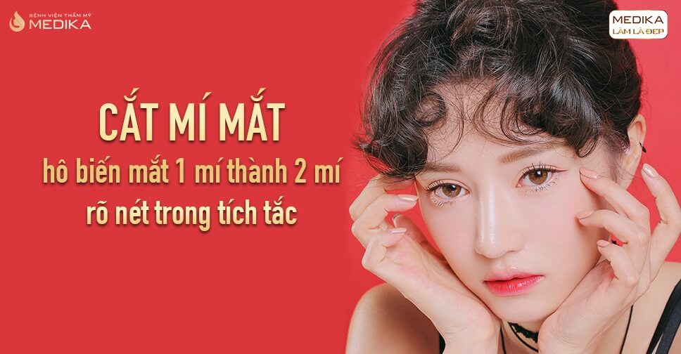 Lưu ý sau khi cắt mí mắt những vấn đề cần quan tâm