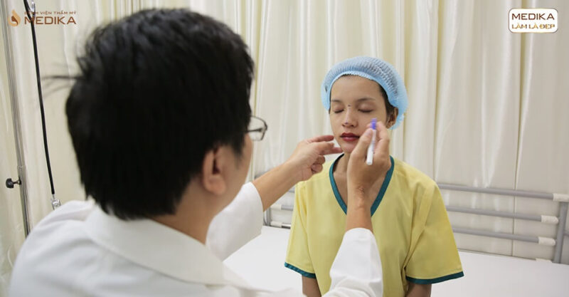 Nâng mũi sụn sườn có nguy hiểm đến cơ thể bạn từ Bệnh viện thẩm mỹ MEDIKA?