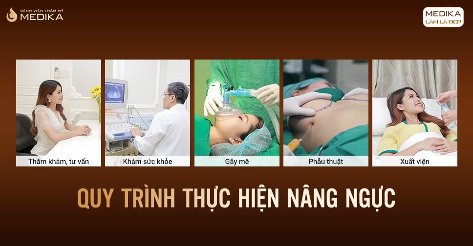 Quy trình thực hiện nâng vòng 1 túi xốp Polytech - Bệnh viện thẩm mỹ MEDIKA