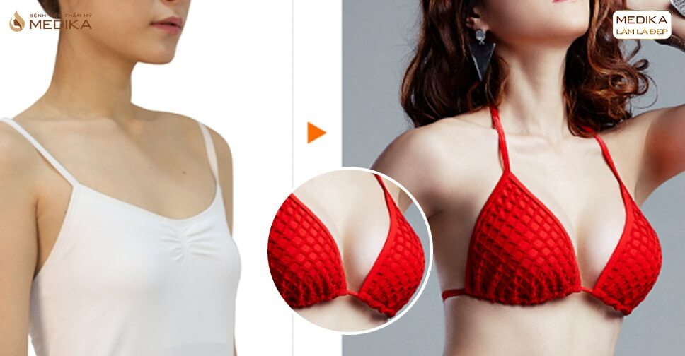 Bikini đỏ với hình ảnh trước sau nâng ngực
