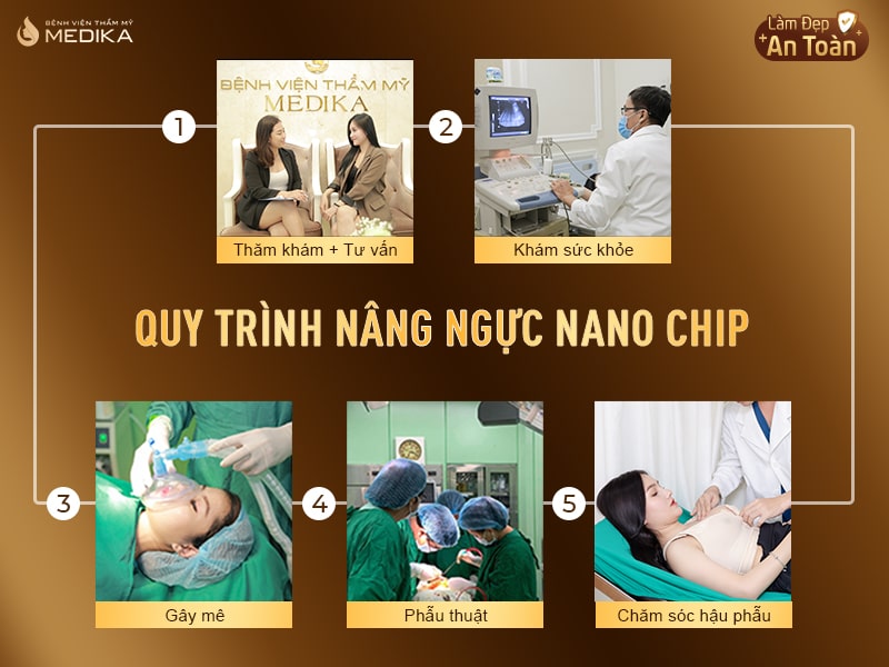 Quy trình nâng ngực Nano Chip