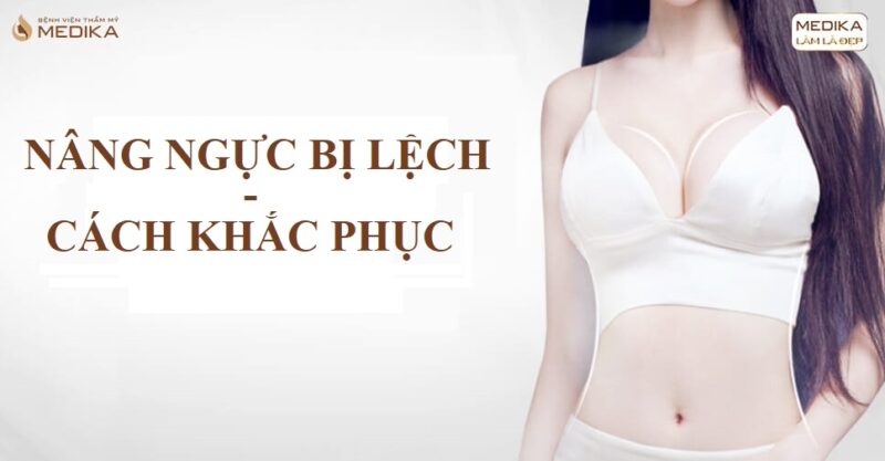 Nâng ngực bị lệch và cách khắc phục