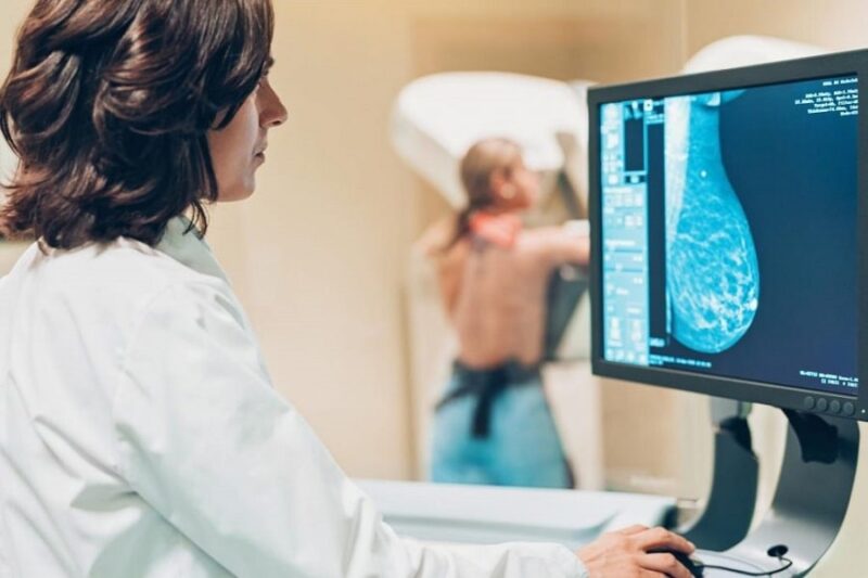 Chụp X-quang ngực