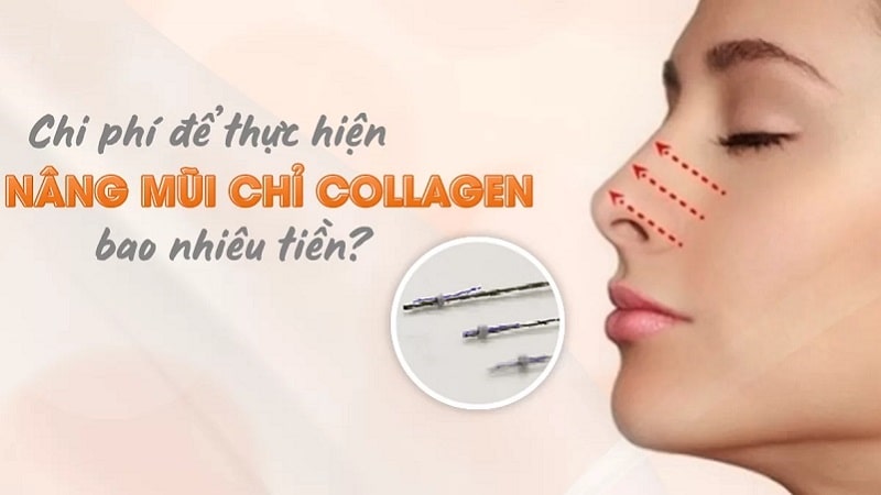 Nâng mũi chỉ collagen giá bao nhiêu?